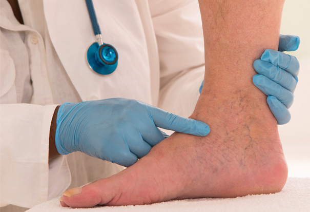 Stock Image of Doctor Testing Patients Foot