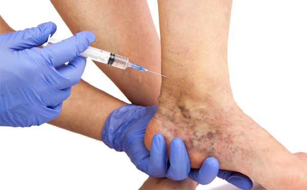 Stock Image of Doctor Injects Injection in Patients Foot