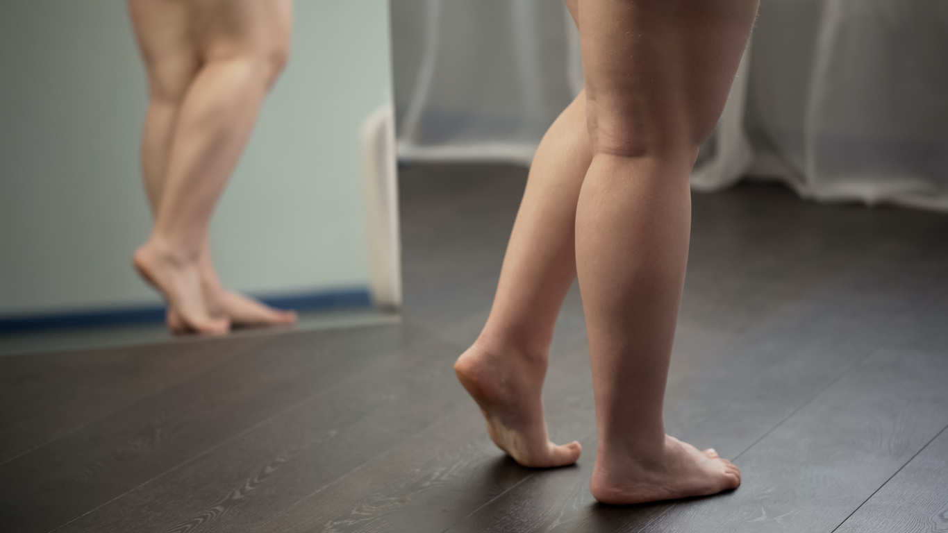 Woman using a mirror to look for varicose veins on her legs . Varicose vein removal in Los Angeles.