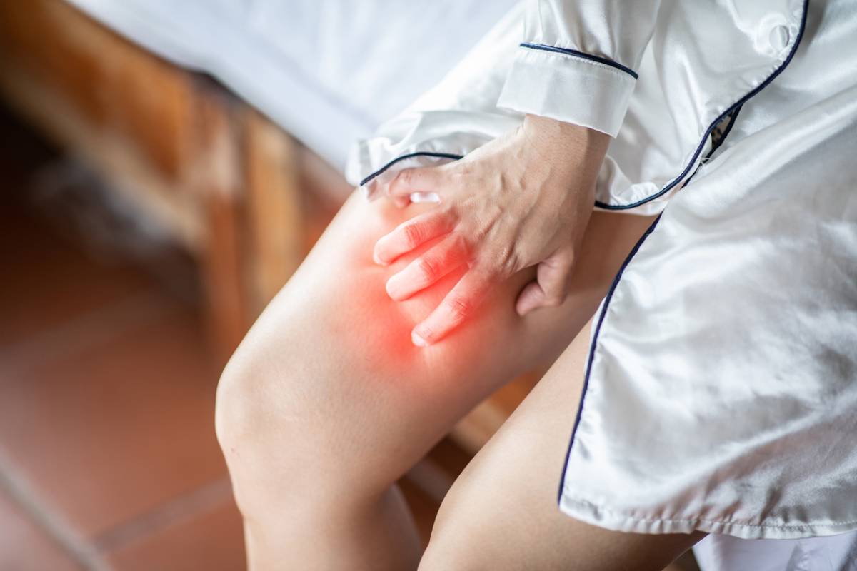 can spider veins be itchy, concept image